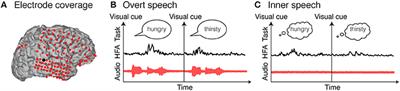 Decoding Inner Speech Using Electrocorticography: Progress and Challenges Toward a Speech Prosthesis